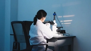 Análisis de la microestructura